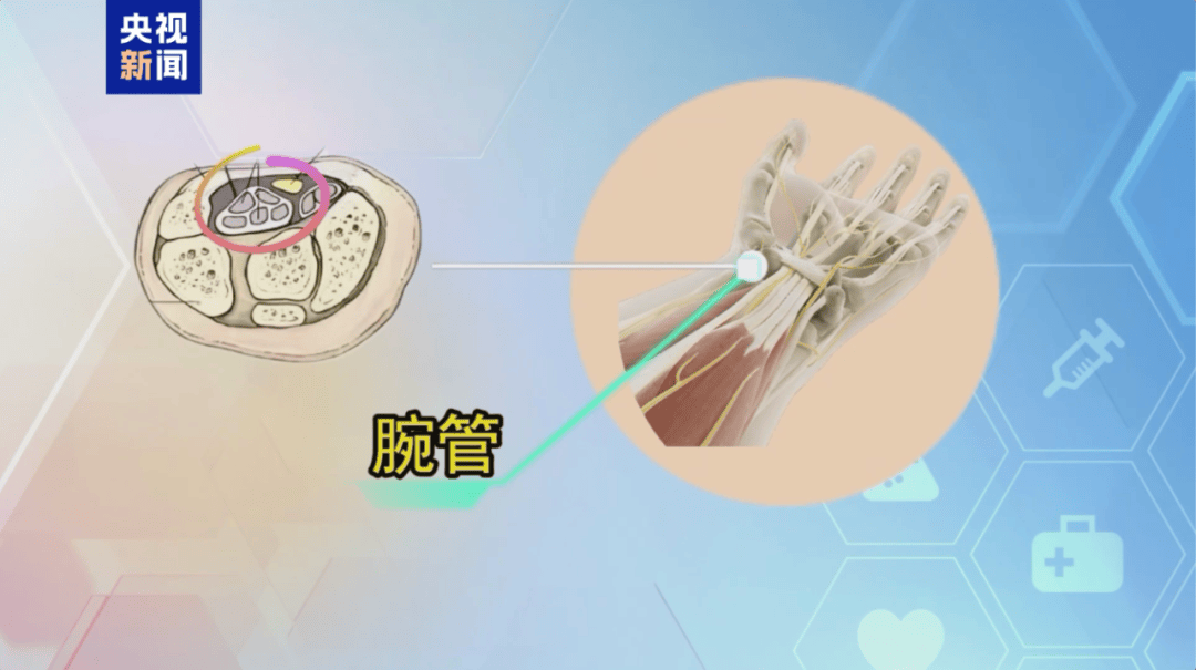 事关收入！8月底前抓紧修改→ | 早安，荔湾